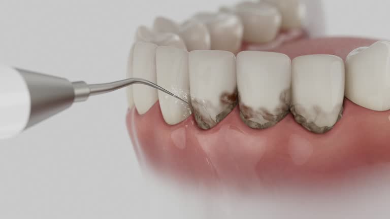Trusted Wisdom Tooth Removal service in Augusta, KS - Dentist Open Now